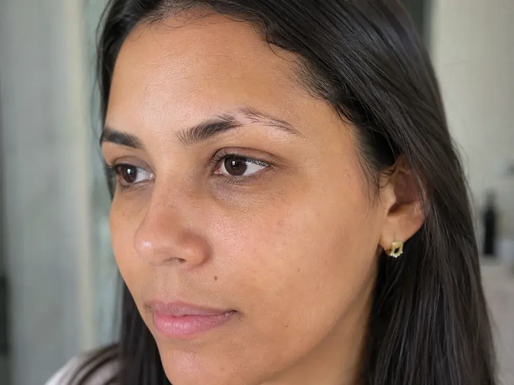 Pessoa com baixa densidade e falhas nas sobrancelhas